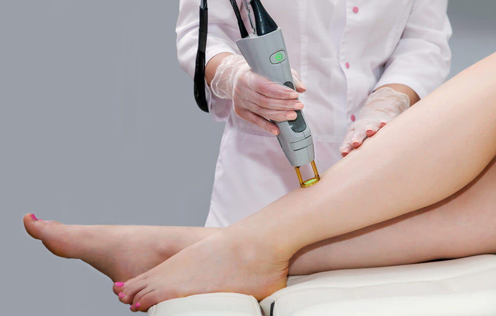4 Laser Hair Removal Myths & Facts