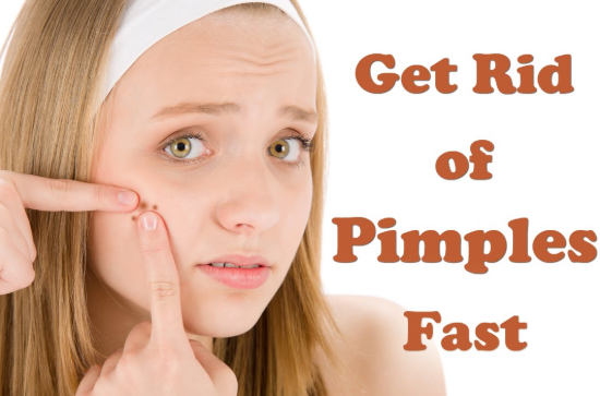 Best Topical Treatments to Get Rid of Pimples, FAST