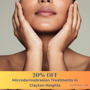 Microdermabrasion Treatments in Clayton Heights