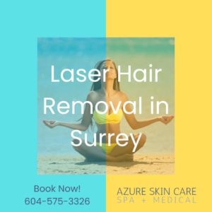 Laser Hair Removal in Surrey