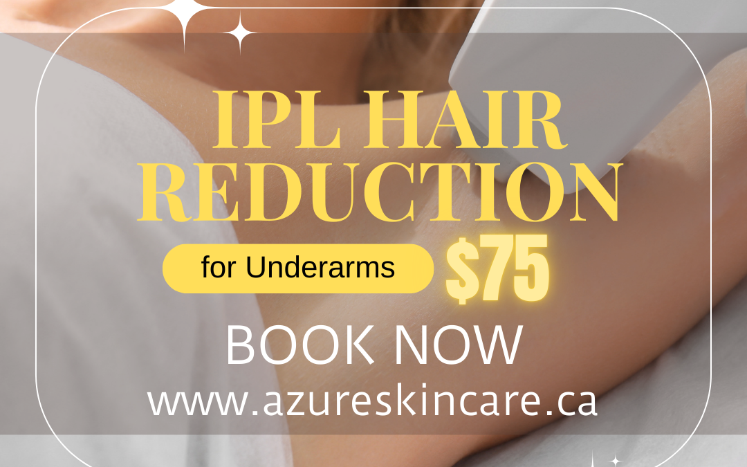 IPL Hair Reduction for Underarms