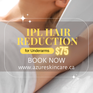 IPL Hair Reduction for Underarms