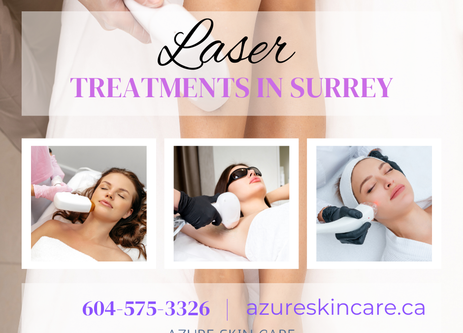 Why Fall is the Perfect Time for Laser Treatments in Surrey