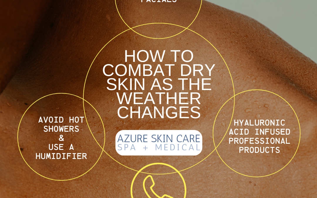 How to Combat Dry Skin as the Weather Changes