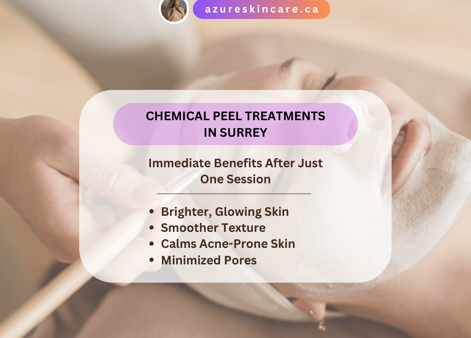 Chemical Peel Treatments in Surrey: Transform Your Skin in Just One Session